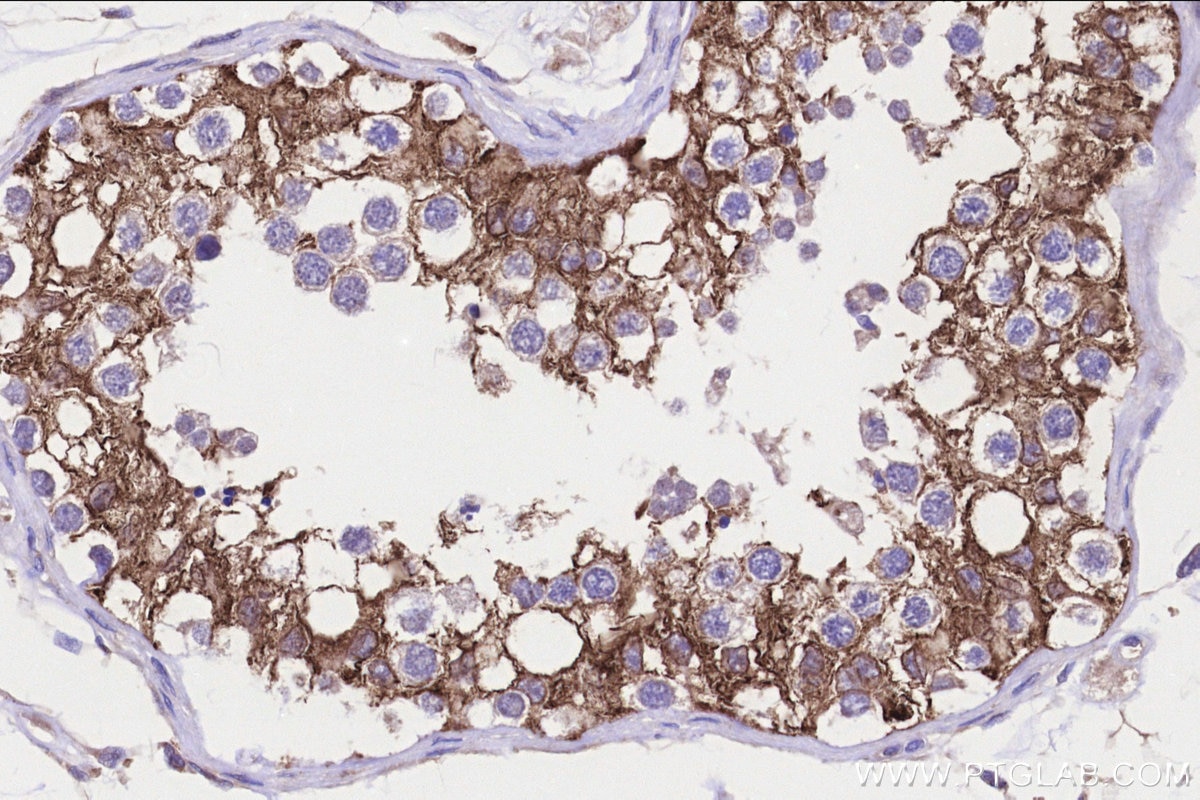 Immunohistochemistry (IHC) staining of human testis tissue using FATE1 Polyclonal antibody (23809-1-AP)