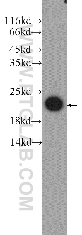 Western Blot (WB) analysis of human testis tissue using FATE1 Polyclonal antibody (23809-1-AP)