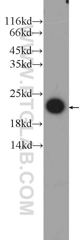 Western Blot (WB) analysis of human testis tissue using FATE1 Polyclonal antibody (23809-1-AP)