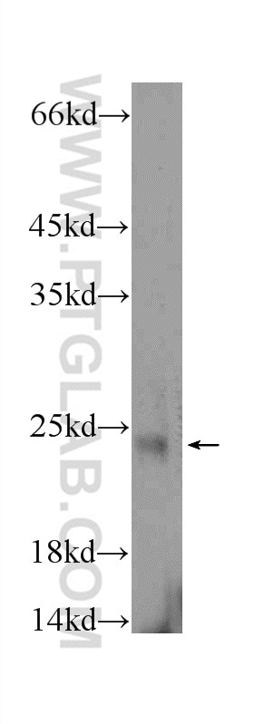 Western Blot (WB) analysis of mouse testis tissue using FATE1 Polyclonal antibody (23809-1-AP)