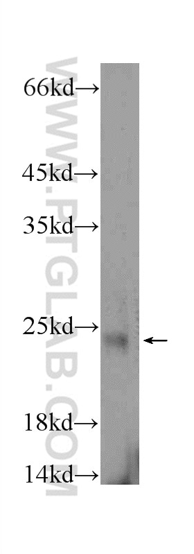 WB analysis of mouse testis using 23809-1-AP