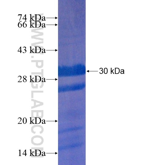 FATE1 fusion protein Ag20757 SDS-PAGE