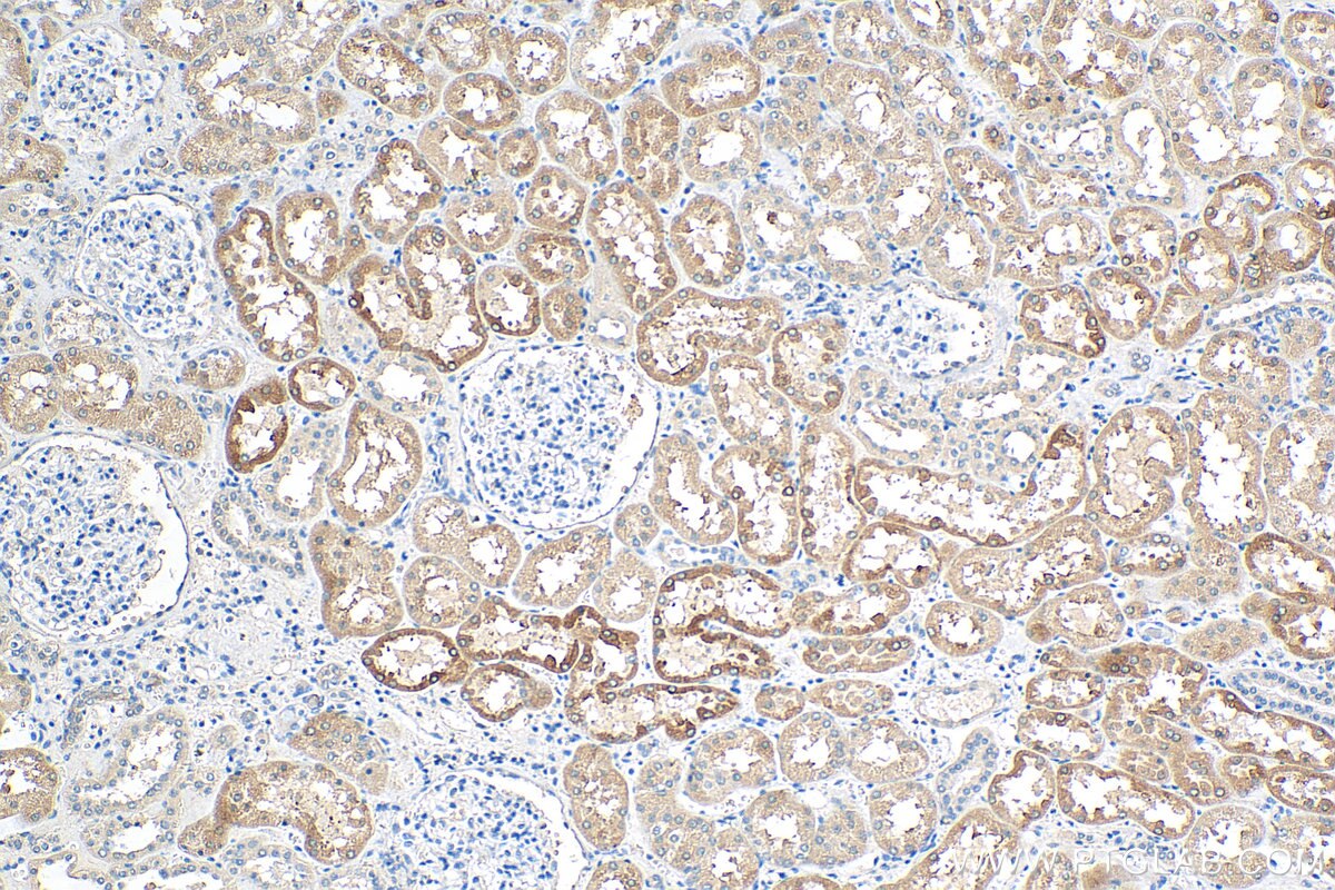 Immunohistochemistry (IHC) staining of human kidney tissue using FATP2 Monoclonal antibody (68074-1-Ig)