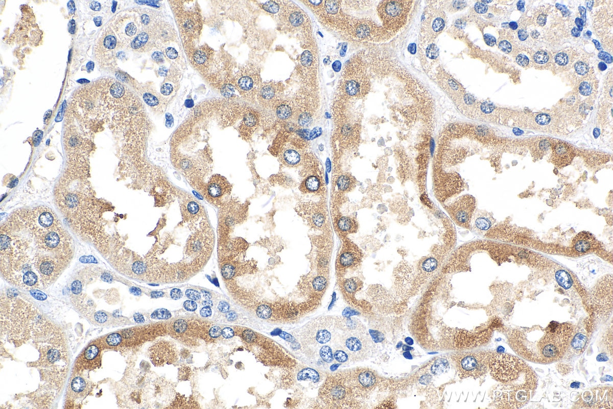 Immunohistochemistry (IHC) staining of human kidney tissue using FATP2 Monoclonal antibody (68074-1-Ig)