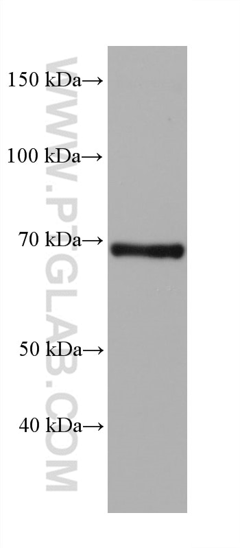 Western Blot (WB) analysis of rat liver tissue using FATP2 Monoclonal antibody (68074-1-Ig)