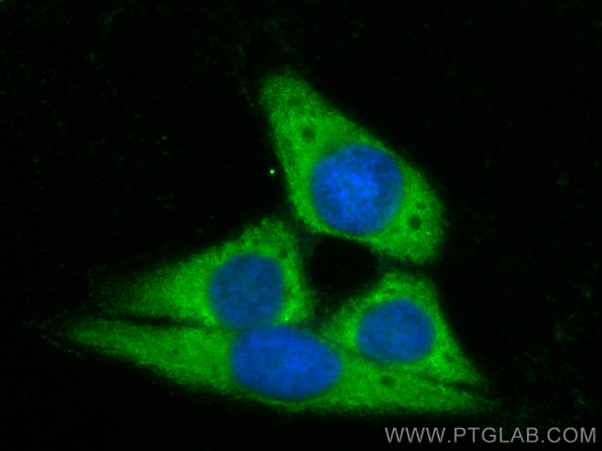 Immunofluorescence (IF) / fluorescent staining of HepG2 cells using CoraLite® Plus 488-conjugated FATP2 Polyclonal ant (CL488-14048)