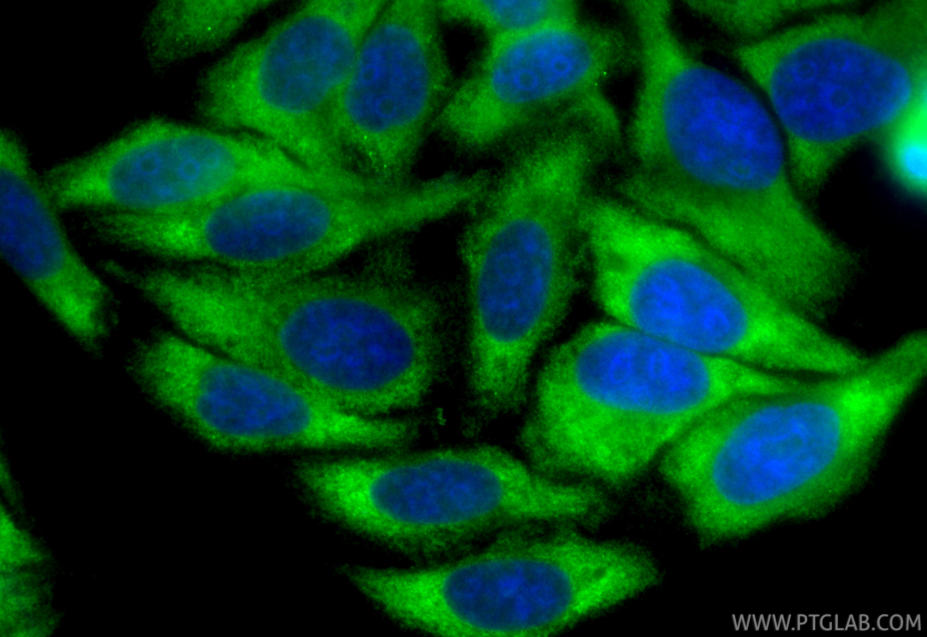 IF Staining of HepG2 using CL488-14048 Immunofluorescence (IF) / fluorescent staining of HepG2 cells using CoraLite® Plus 488-conjugated FATP2 Polyclonal ant (CL488-14048)