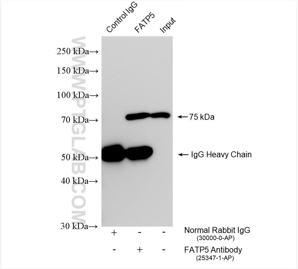 Immunoprecipitation (IP) experiment of rat liver tissue using FATP5 Polyclonal antibody (25347-1-AP)