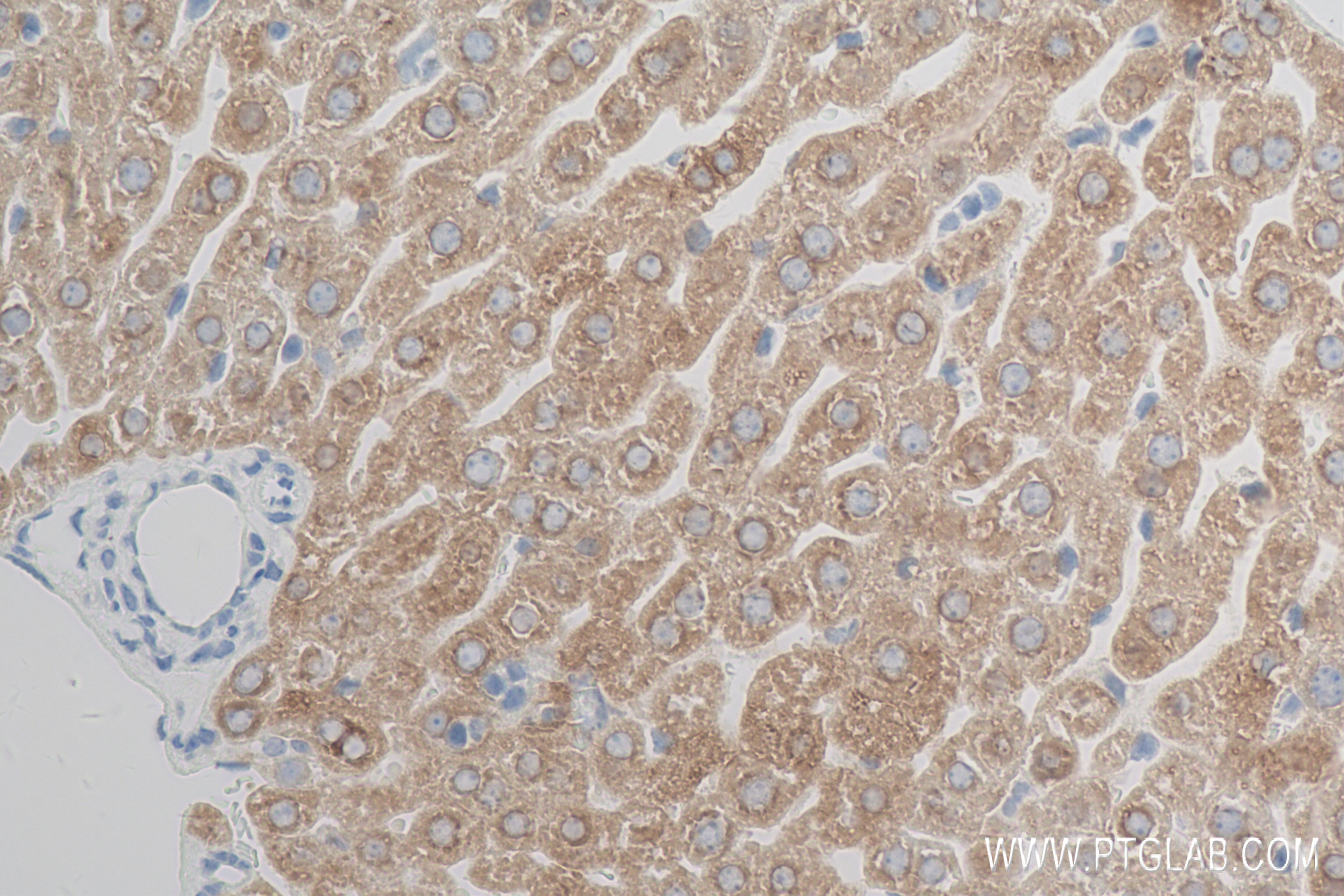 Immunohistochemistry (IHC) staining of mouse liver tissue using FATP5/SLC27A5 Recombinant antibody (84557-1-RR)