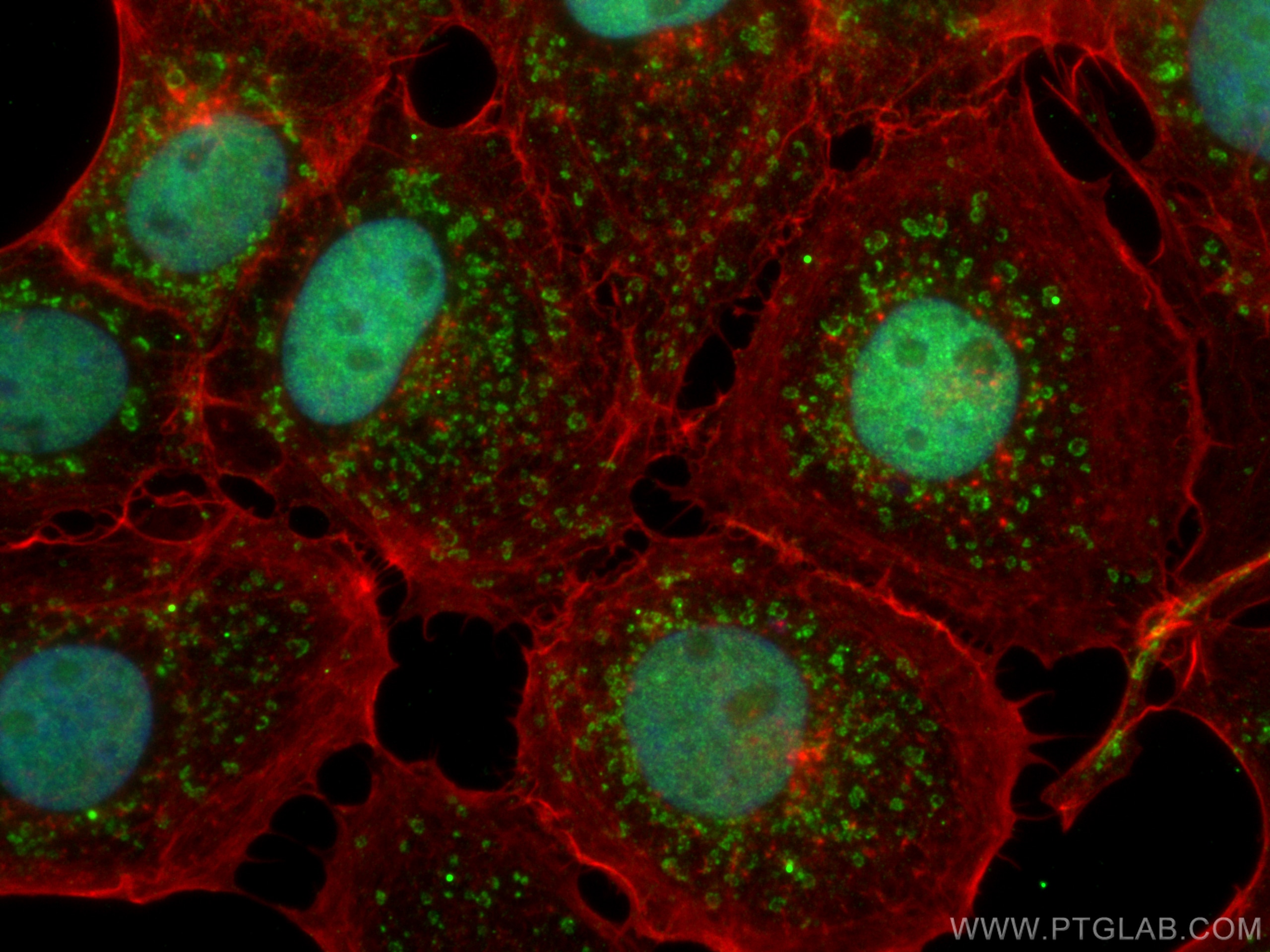 Immunofluorescence (IF) / fluorescent staining of A431 cells using FATS Polyclonal antibody (30190-1-AP)