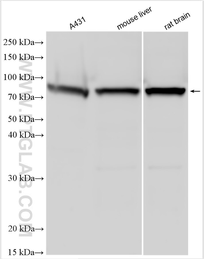 Western Blot (WB) analysis of various lysates using FATS Polyclonal antibody (30190-1-AP)