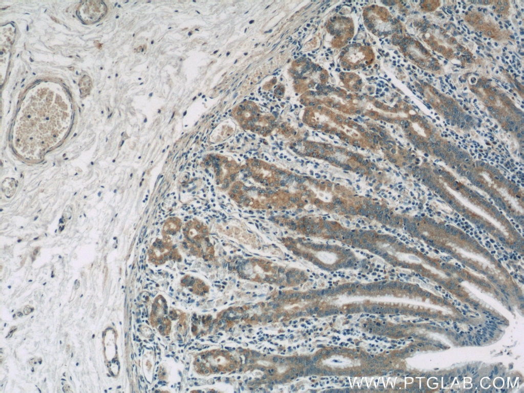 IHC staining of human stomach using 13581-1-AP