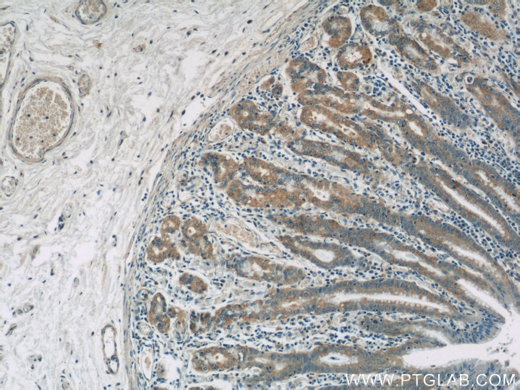 Immunohistochemistry (IHC) staining of human stomach tissue using FAU Polyclonal antibody (13581-1-AP)