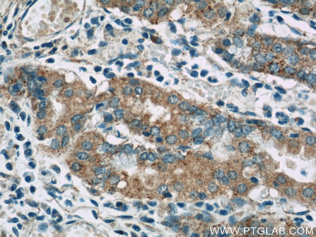 Immunohistochemistry (IHC) staining of human stomach tissue using FAU Polyclonal antibody (13581-1-AP)
