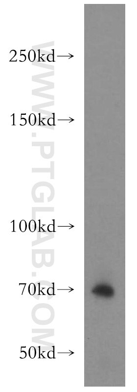 Western Blot (WB) analysis of mouse brain tissue using FBF1 Polyclonal antibody (11394-1-AP)