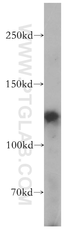 Western Blot (WB) analysis of mouse liver tissue using FBF1 Polyclonal antibody (11531-1-AP)
