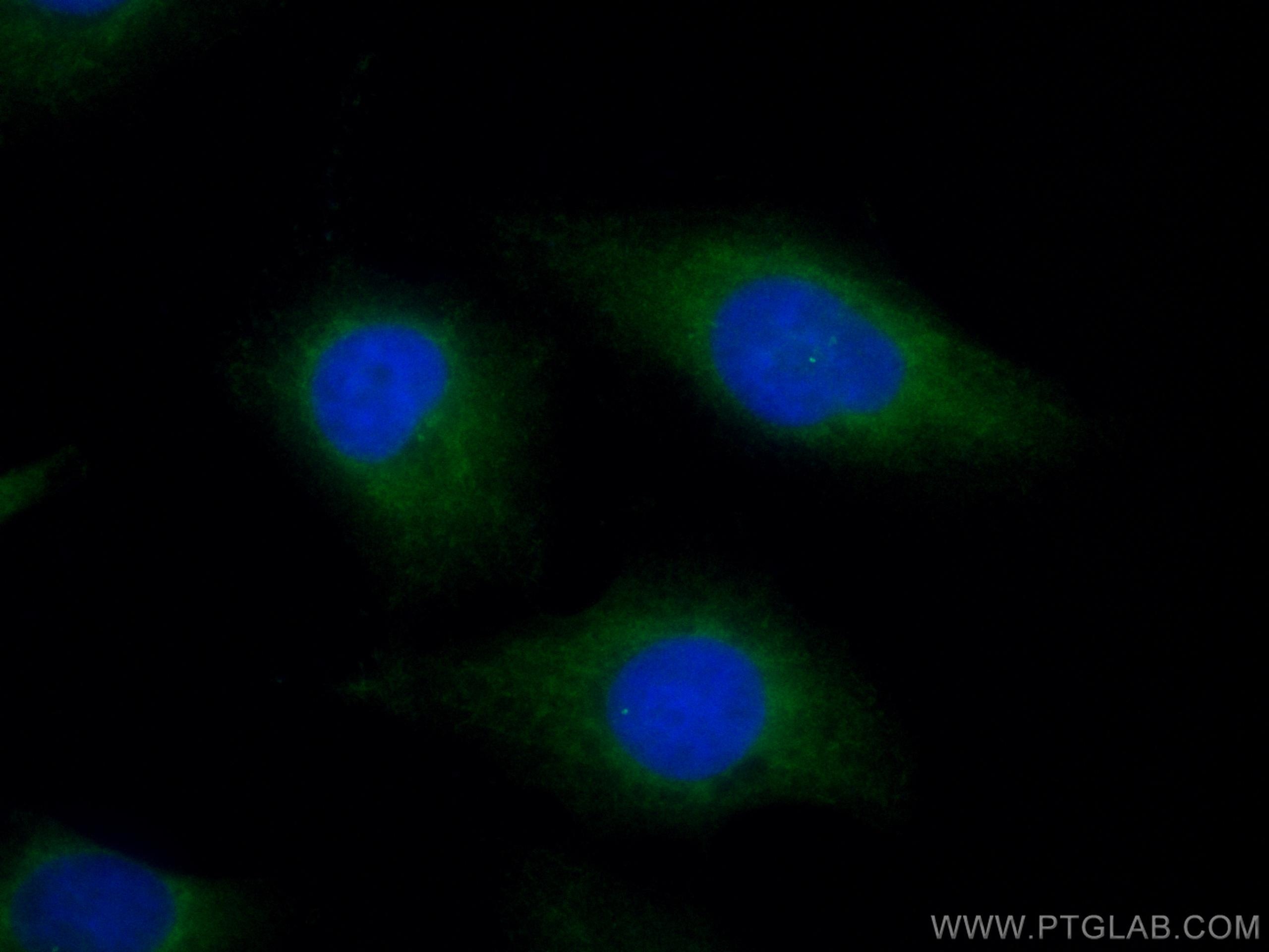 Immunofluorescence (IF) / fluorescent staining of HUVEC cells using CoraLite® Plus 488-conjugated FBF1 Polyclonal anti (CL488-11531)