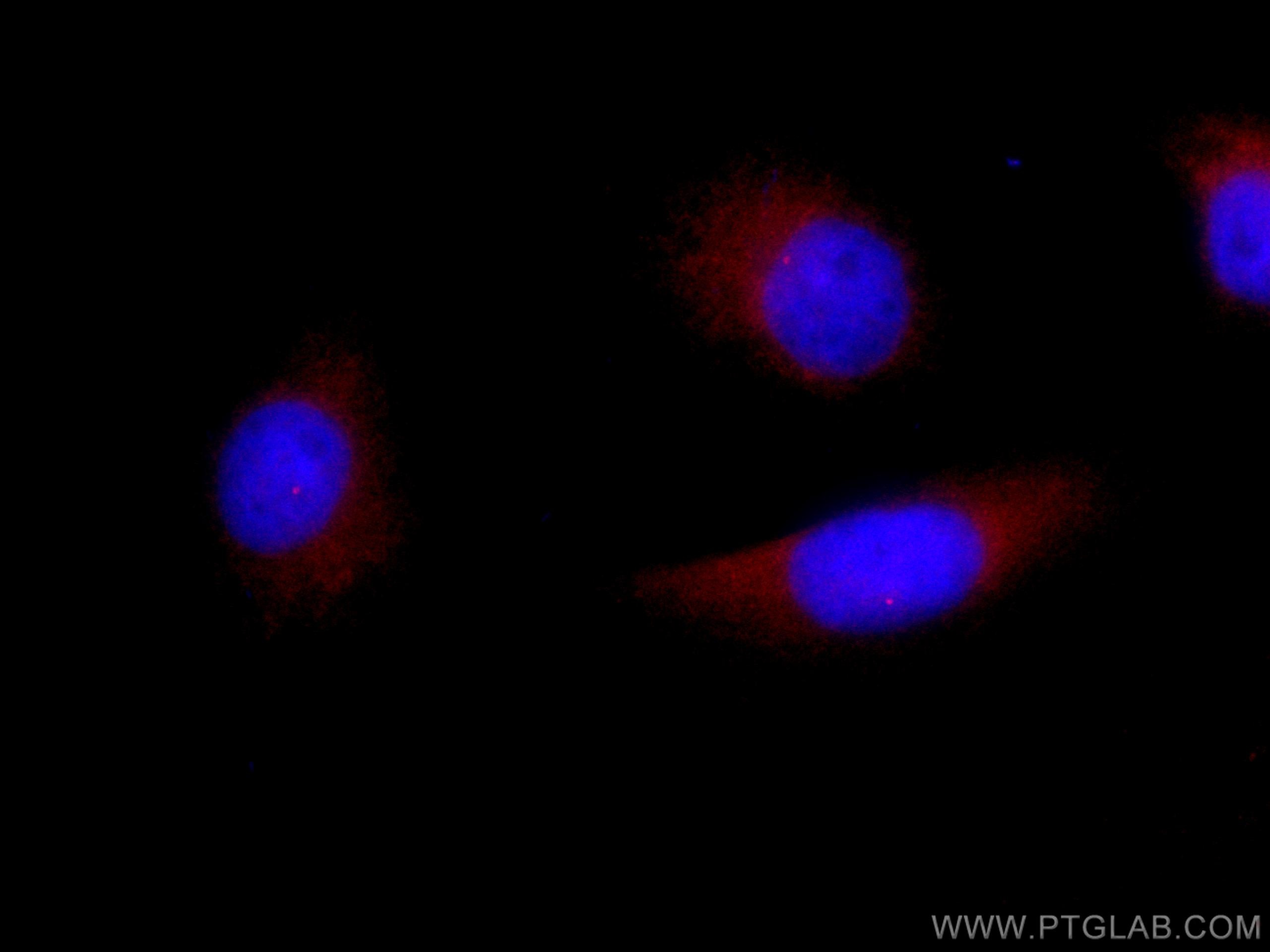 Immunofluorescence (IF) / fluorescent staining of HUVEC cells using CoraLite®594-conjugated FBF1 Polyclonal antibody (CL594-11531)