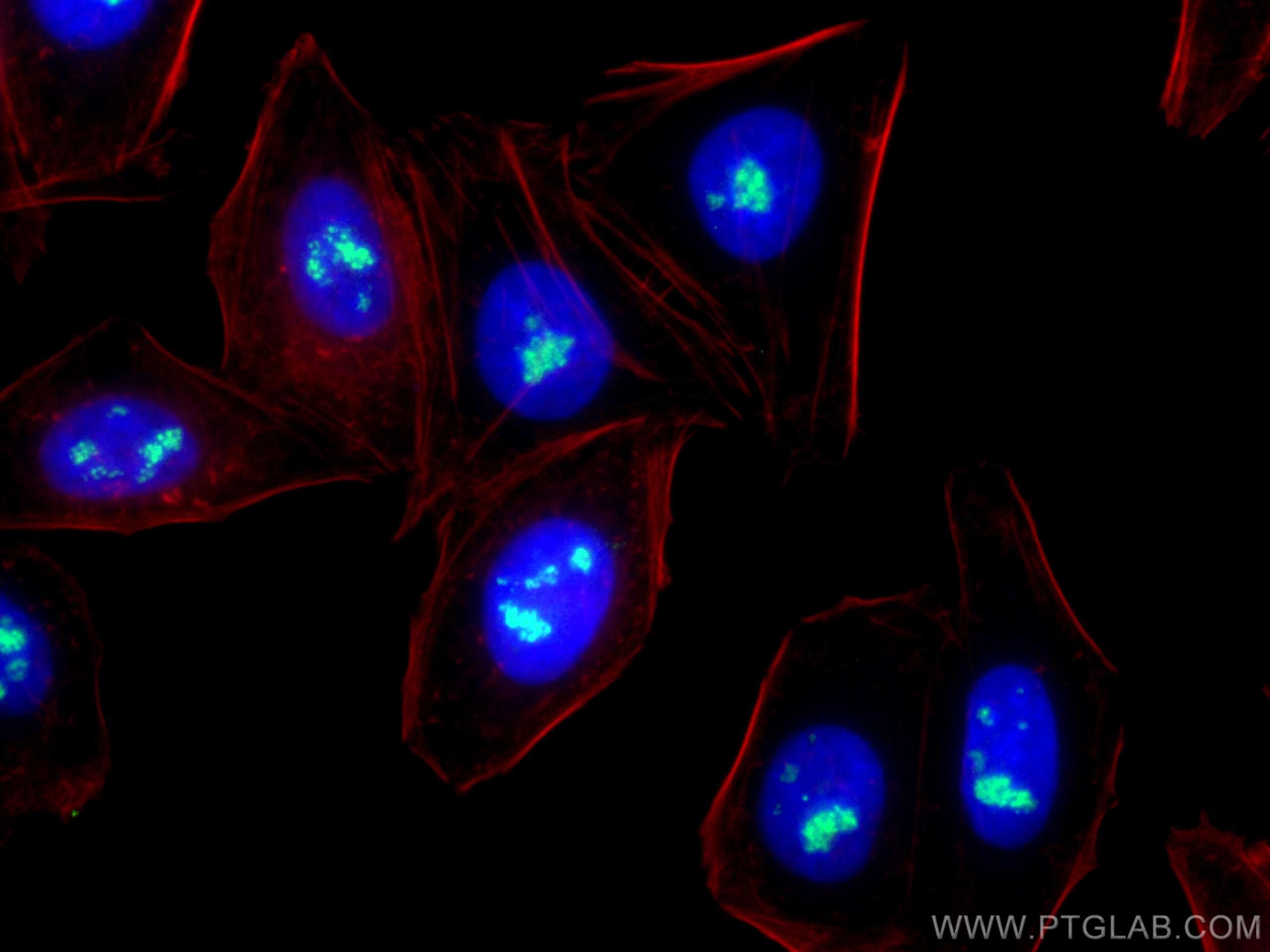 IF Staining of HepG2 using 16021-1-AP