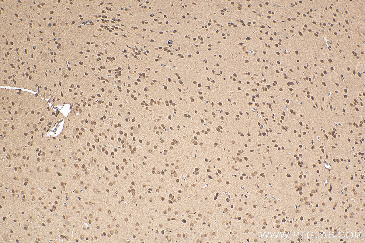 Immunohistochemistry (IHC) staining of mouse brain tissue using FBL Polyclonal antibody (16021-1-AP)