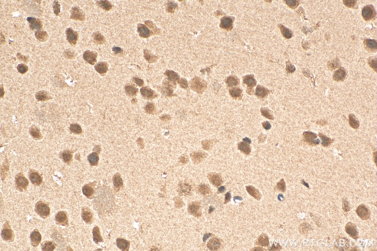 Immunohistochemistry (IHC) staining of mouse brain tissue using FBL Polyclonal antibody (16021-1-AP)