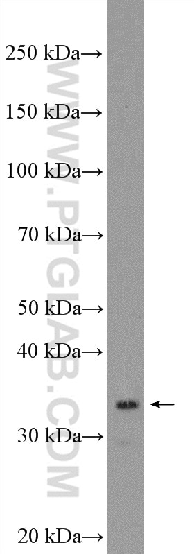 WB analysis of mouse kidney using 16021-1-AP