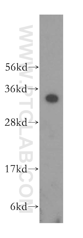 Western Blot (WB) analysis of A375 cells using FBL Polyclonal antibody (16021-1-AP)