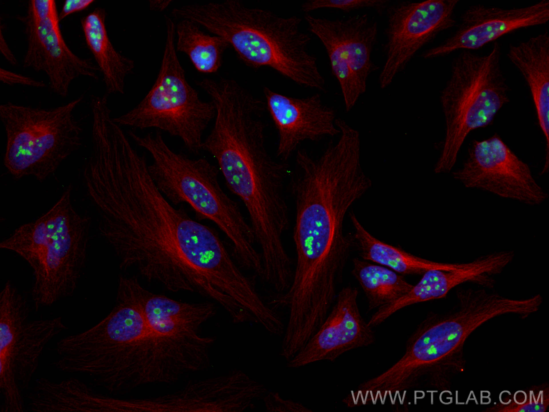 Immunofluorescence (IF) / fluorescent staining of HeLa cells using FBL Monoclonal antibody (66985-1-Ig)