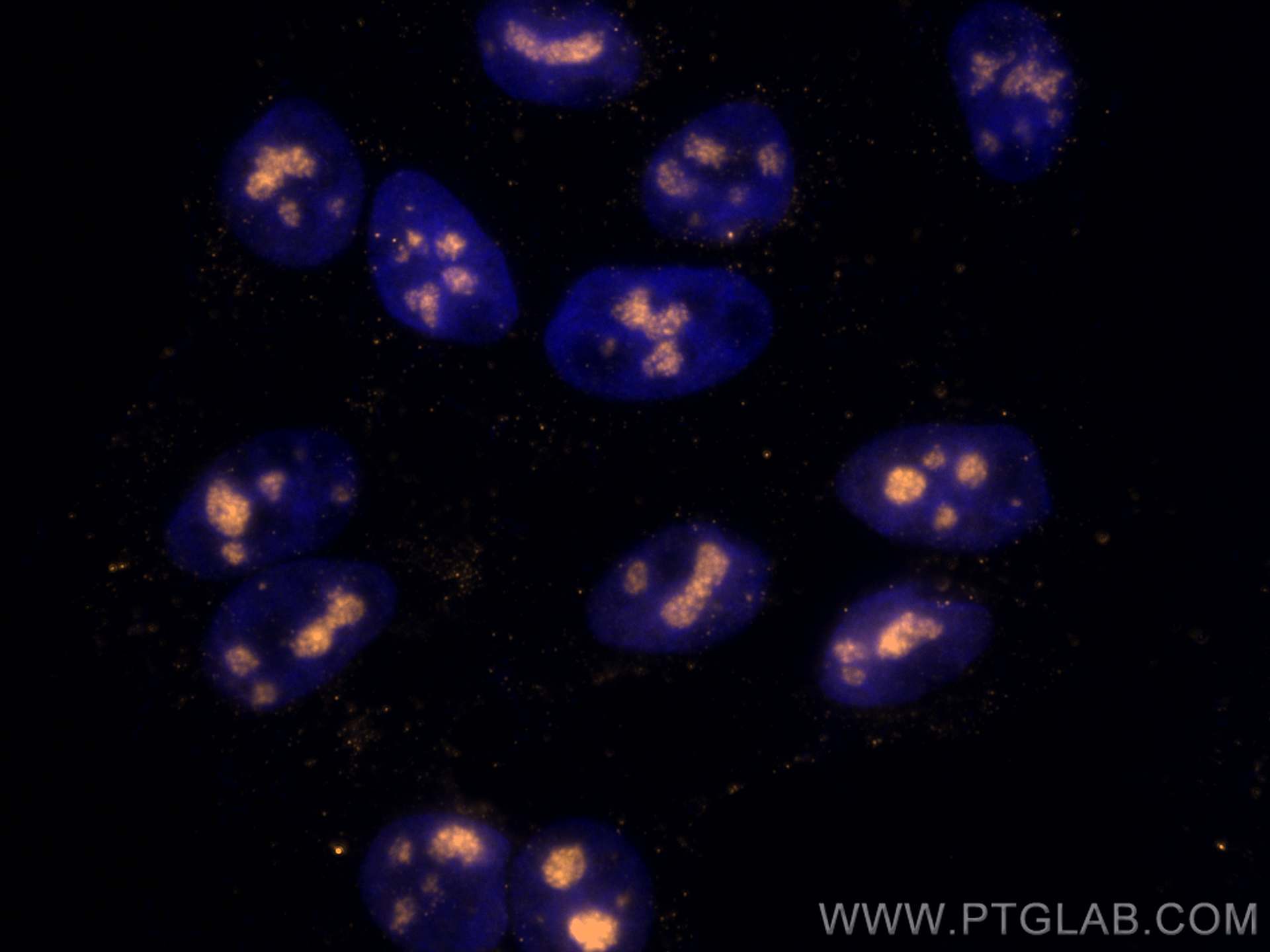 IF Staining of HepG2 using CL555-66985