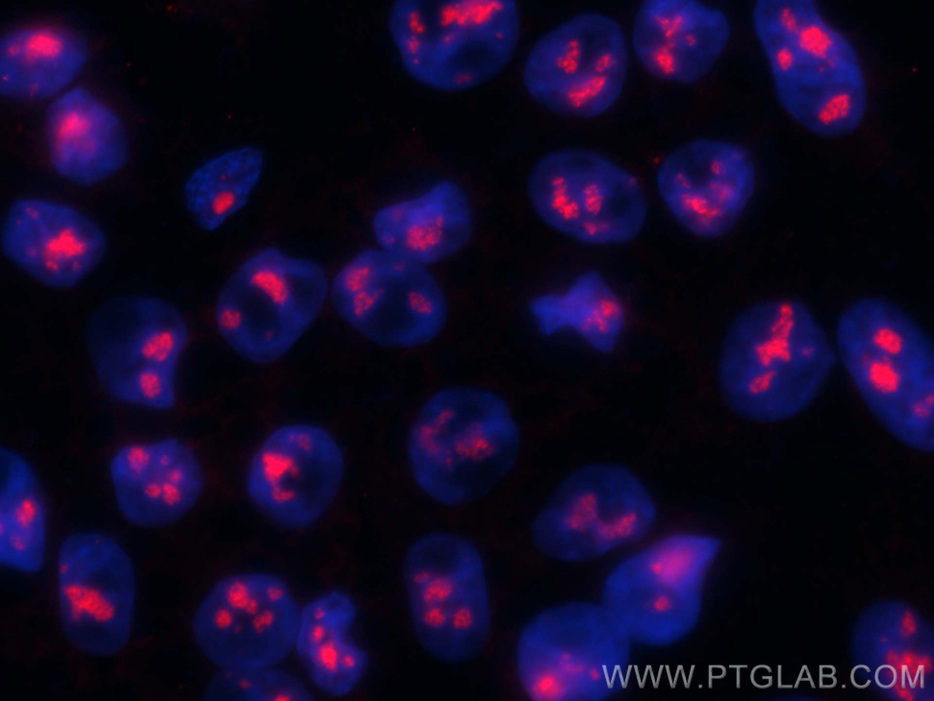 Immunofluorescence (IF) / fluorescent staining of HepG2 cells using CoraLite®594-conjugated FBL Monoclonal antibody (CL594-66985)