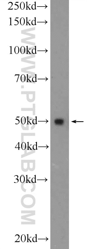 Western Blot (WB) analysis of HEK-293 cells using FBLIM1 Polyclonal antibody (13349-1-AP)