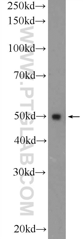 Western Blot (WB) analysis of HEK-293 cells using FBLIM1 Polyclonal antibody (13349-1-AP)