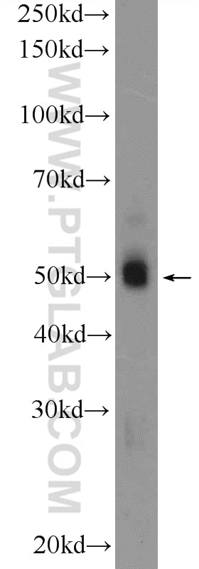 Western Blot (WB) analysis of HEK-293 cells using FBLIM1 Polyclonal antibody (13349-1-AP)