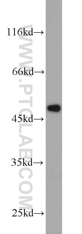 Western Blot (WB) analysis of K-562 cells using FBLIM1 Polyclonal antibody (13349-1-AP)