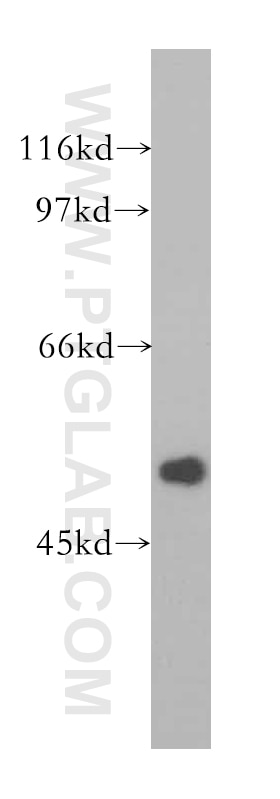 Western Blot (WB) analysis of human heart tissue using FBLIM1 Polyclonal antibody (13349-1-AP)