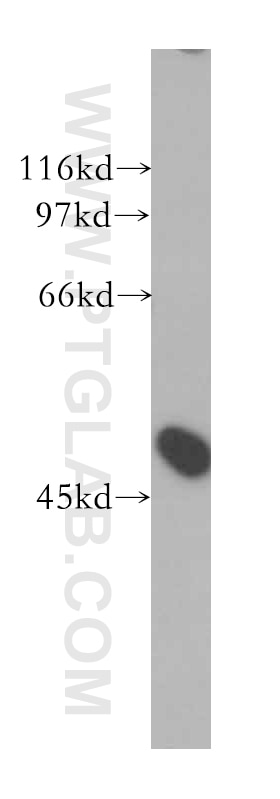 Western Blot (WB) analysis of HeLa cells using FBLIM1 Polyclonal antibody (13349-1-AP)