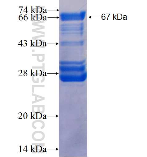 FBLIM1 fusion protein Ag3907 SDS-PAGE