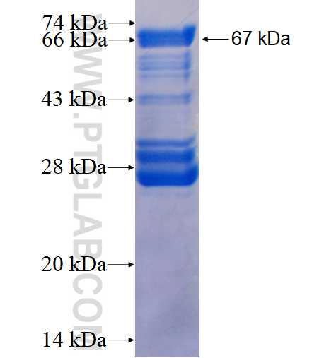FBLIM1 fusion protein Ag3907 SDS-PAGE