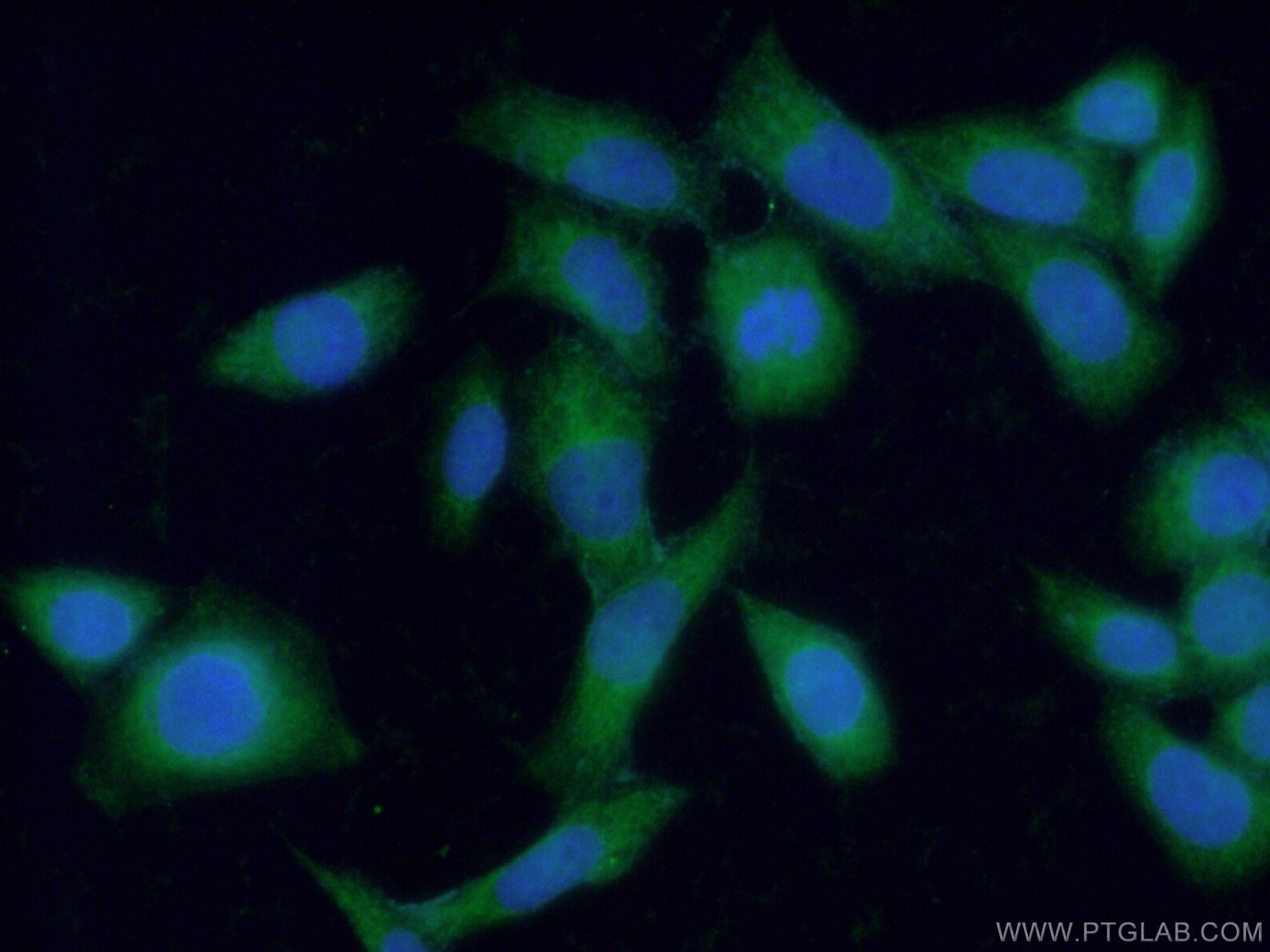 Immunofluorescence (IF) / fluorescent staining of HeLa cells using Fibulin-1 Polyclonal antibody (20425-1-AP)