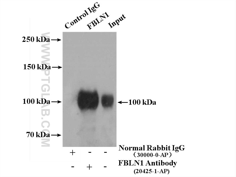 Immunoprecipitation (IP) experiment of human placenta tissue using Fibulin-1 Polyclonal antibody (20425-1-AP)