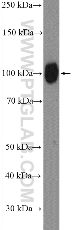 Western Blot (WB) analysis of human placenta tissue using Fibulin-1 Polyclonal antibody (20425-1-AP)