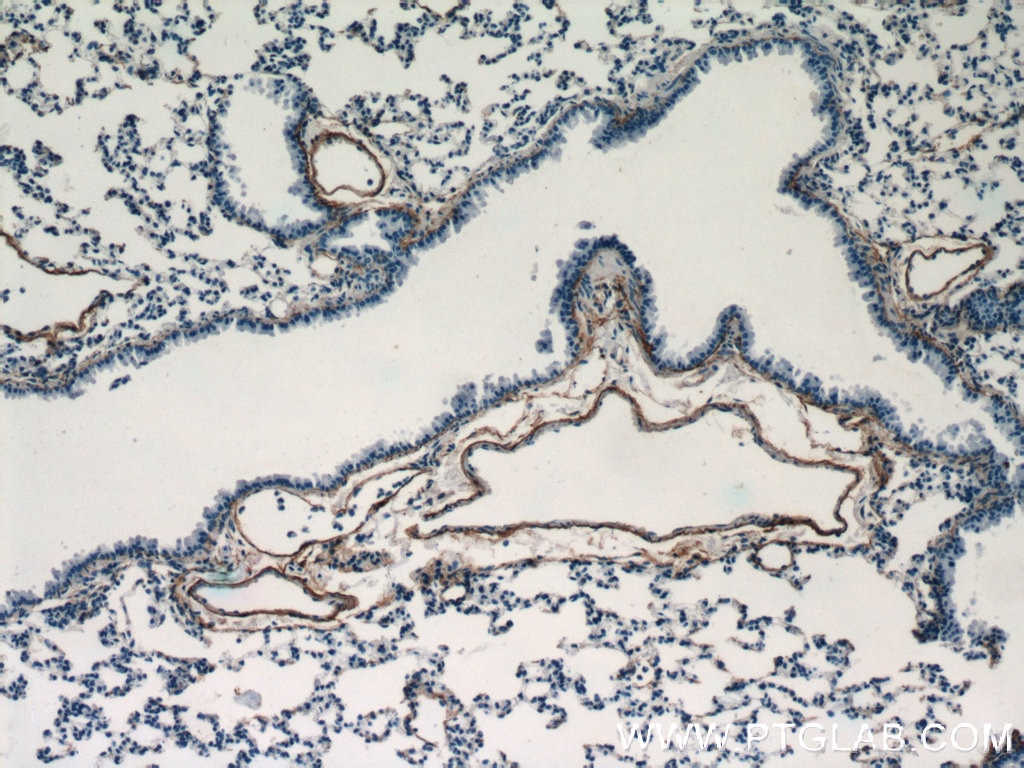 Immunohistochemistry (IHC) staining of mouse lung tissue using Fibulin 5 Polyclonal antibody (12188-1-AP)