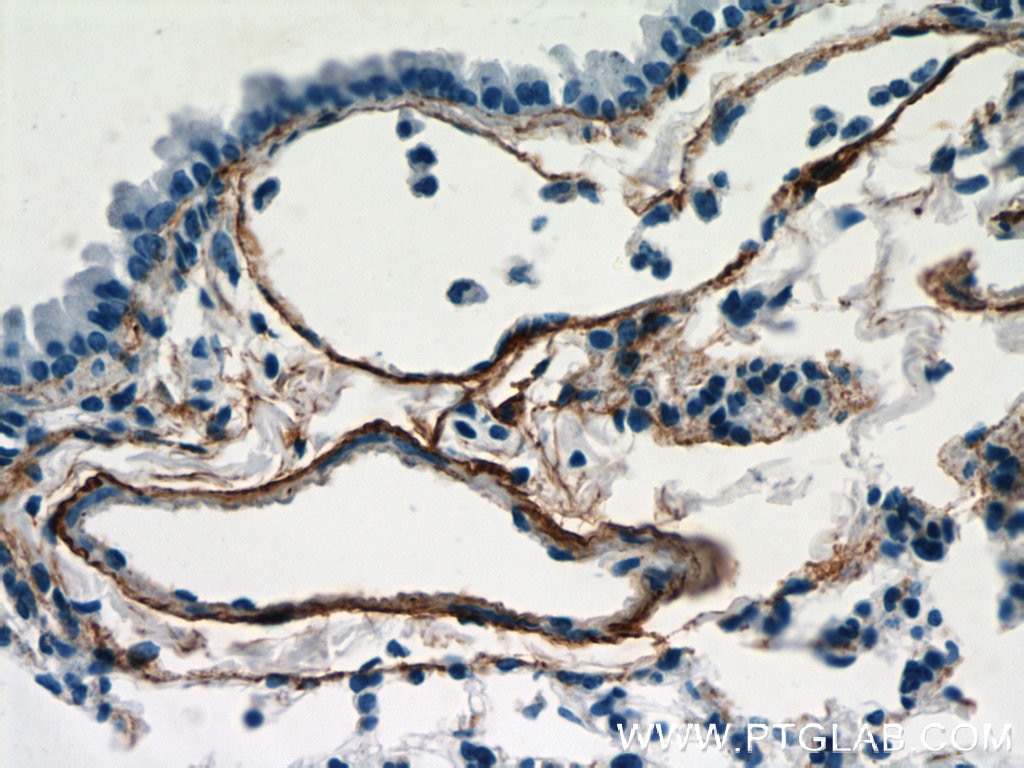 Immunohistochemistry (IHC) staining of mouse lung tissue using Fibulin 5 Polyclonal antibody (12188-1-AP)