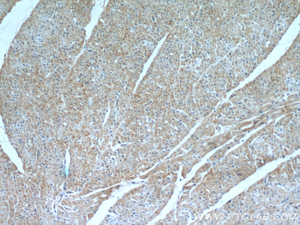 IHC staining of human heart using 12188-1-AP
