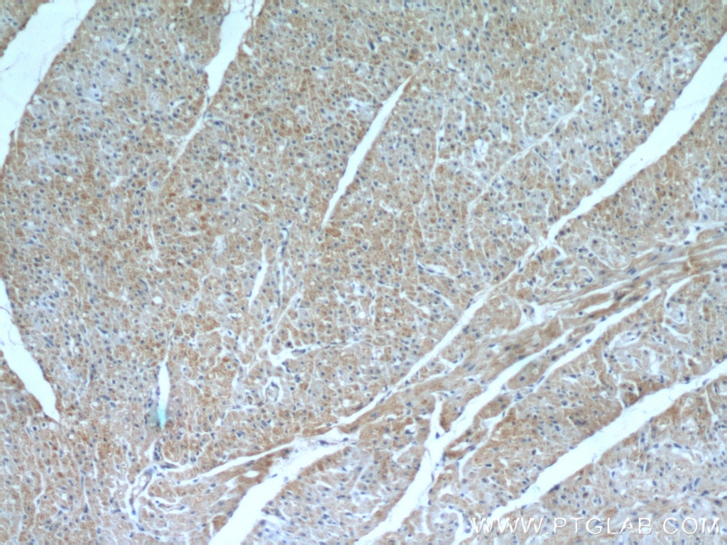 Immunohistochemistry (IHC) staining of human heart tissue using Fibulin 5 Polyclonal antibody (12188-1-AP)