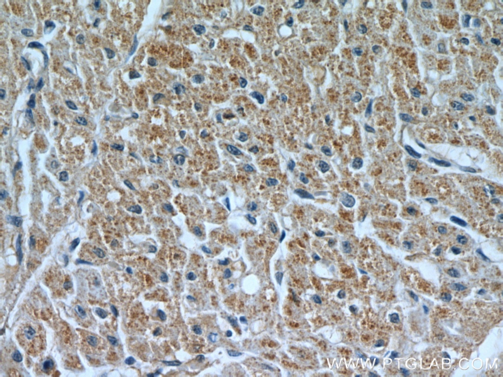 IHC staining of human heart using 12188-1-AP