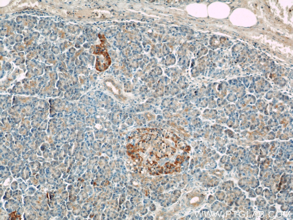 Immunohistochemistry (IHC) staining of human pancreas tissue using Fibulin 5 Polyclonal antibody (12188-1-AP)