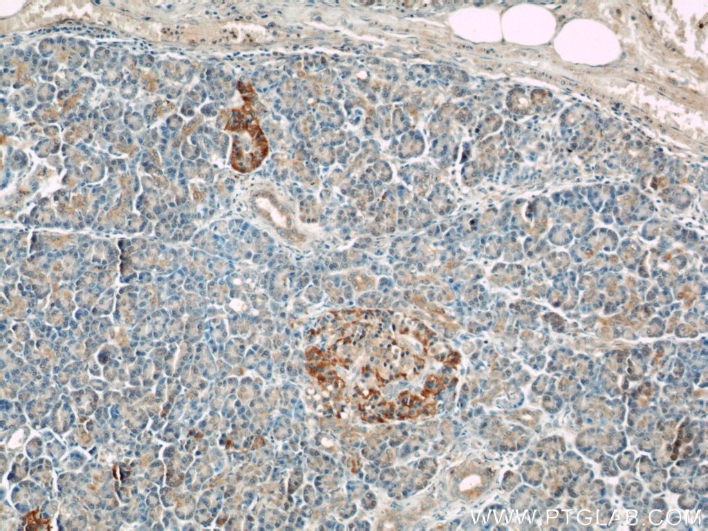 IHC staining of human pancreas using 12188-1-AP