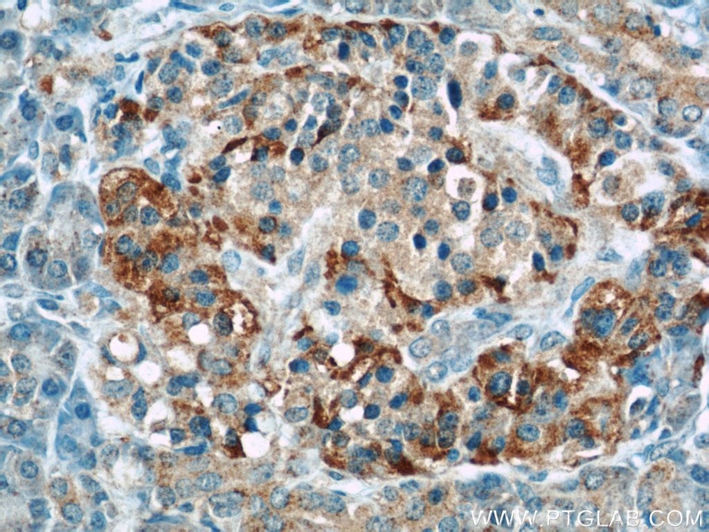 Immunohistochemistry (IHC) staining of human pancreas tissue using Fibulin 5 Polyclonal antibody (12188-1-AP)