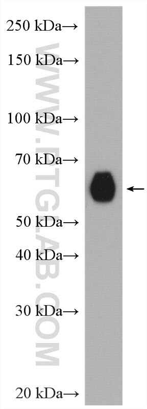 Western Blot (WB) analysis of mouse heart tissue using Fibulin 5 Polyclonal antibody (12188-1-AP)
